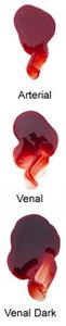 Picture of Mouldlife Kensington Gore Arterial Blood 50g