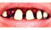 Picture of Sp. Offer - Billy Bob Teeth - Hunting & Fishing