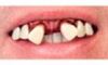 Picture of Sp. Offer - Billy Bob Teeth - Aviator