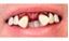 Picture of Sp. Offer - Billy Bob Teeth - Aviator