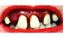 Picture of Sp. Offer - Billy Bob Teeth - Betty Bob